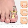 Professional ingrown toenail corrector - lifter - stainless steelEquipment