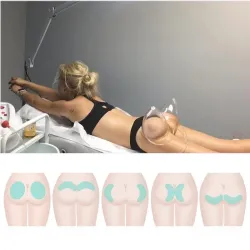 Buttcock / breast enlargement - vacuum machine - massager with 6 suction cupsMassage