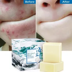 Honey Soap - Goat Milk - Remove Acne - - Clean Skin - Blackhead RemoverSkin