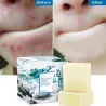 Honigseife - Ziegenmilch - Acne entfernen - Clean Skin - Blackhead Remover