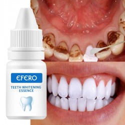 Zahnaufhellung Serum - Gel - Mundhygiene - Zahnpasta
