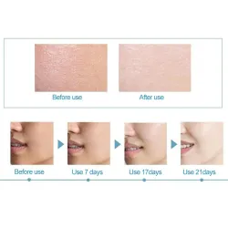 Hyaluronsäure Essenz - feuchtigkeitsspendend - Antifalten - Antiallergie - Gesichtslift Serum