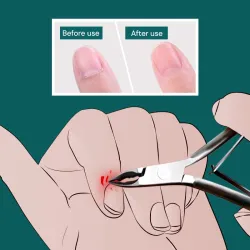 Profi Nagelhaut-/Nagelknipser - Edelstahl