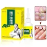 15ml - Nagelpilzbehandlung - Entfernung - Nagelreparaturflüssigkeit