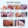15ml - Nagelpilzbehandlung - Entfernung - Nagelreparaturflüssigkeit