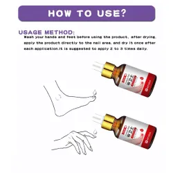 Gel zur Entfernung von Zehennagelpilz - Serum - Anti-Infektion / Paronychie / Onychomykose - 10ml