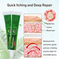 Psoriasis-Creme - Dermatitis - Ekzem - Anti-Juckreiz - Kräuter-antibakterielle Salbe