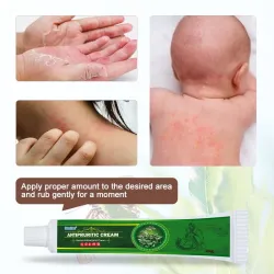 Psoriasis-Creme - Dermatitis - Ekzem - Anti-Juckreiz - Kräuter-antibakterielle Salbe