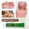 Psoriasis-Creme - Dermatitis - Ekzem - Anti-Juckreiz - Kräuter-antibakterielle Salbe