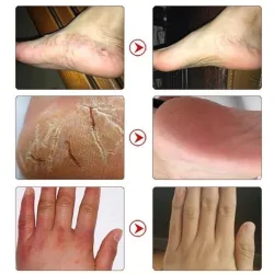 Pferdeölsalbe - Reparaturcreme für Hände / Füße - Feuchtigkeitscreme