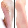 Horse oil ointment - hand / foot repair cream - moisturizerSkin