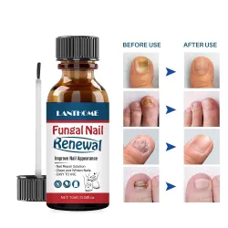 Antimykotisches Öl für Nägel - flüssiges Reparaturserum