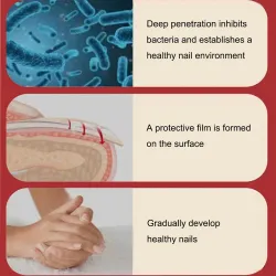 Onychomycosis removal oil - essence liquid serumTreatment