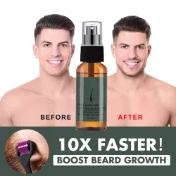 Bart- / Haarwachstums-Essenz - Spray - mit Nadelrollen-Massagegerät - gegen Haarausfall