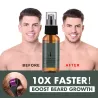 Bart- / Haarwachstums-Essenz - Spray - mit Nadelrollen-Massagegerät - gegen Haarausfall
