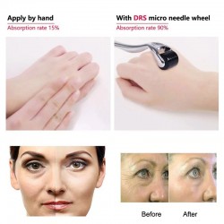 Mikronadel – Titan-Derma-Roller – Anti-Falten – verjüngendes Gesichts-/Körpermassagegerät