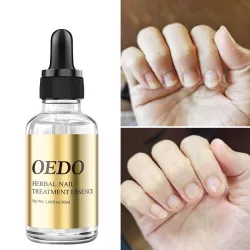 Nagelpilzbehandlung - ätherisches Öl