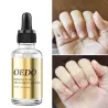 Nagelpilzbehandlung - ätherisches Öl