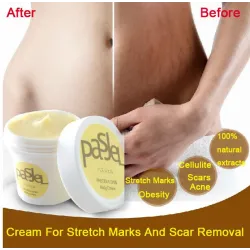 Stretchmarken & Narben Entfernung Creme