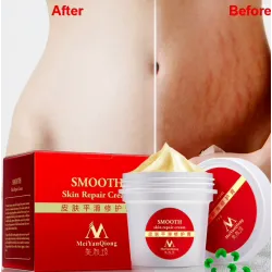 Stretchmarken & Narben Entfernung Reparatur Körper Creme