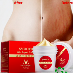 Stretch marks & scars removal repair body cream