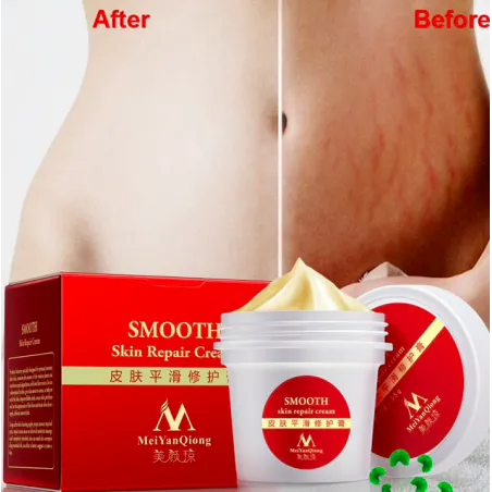 Stretchmarken & Narben Entfernung Reparatur Körper Creme