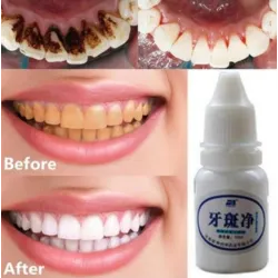 Teeweißwasser 10 ml