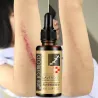 Lavender Massageöl - Narbenentfernung - Anti Akne - Hyaluronsäure Serum